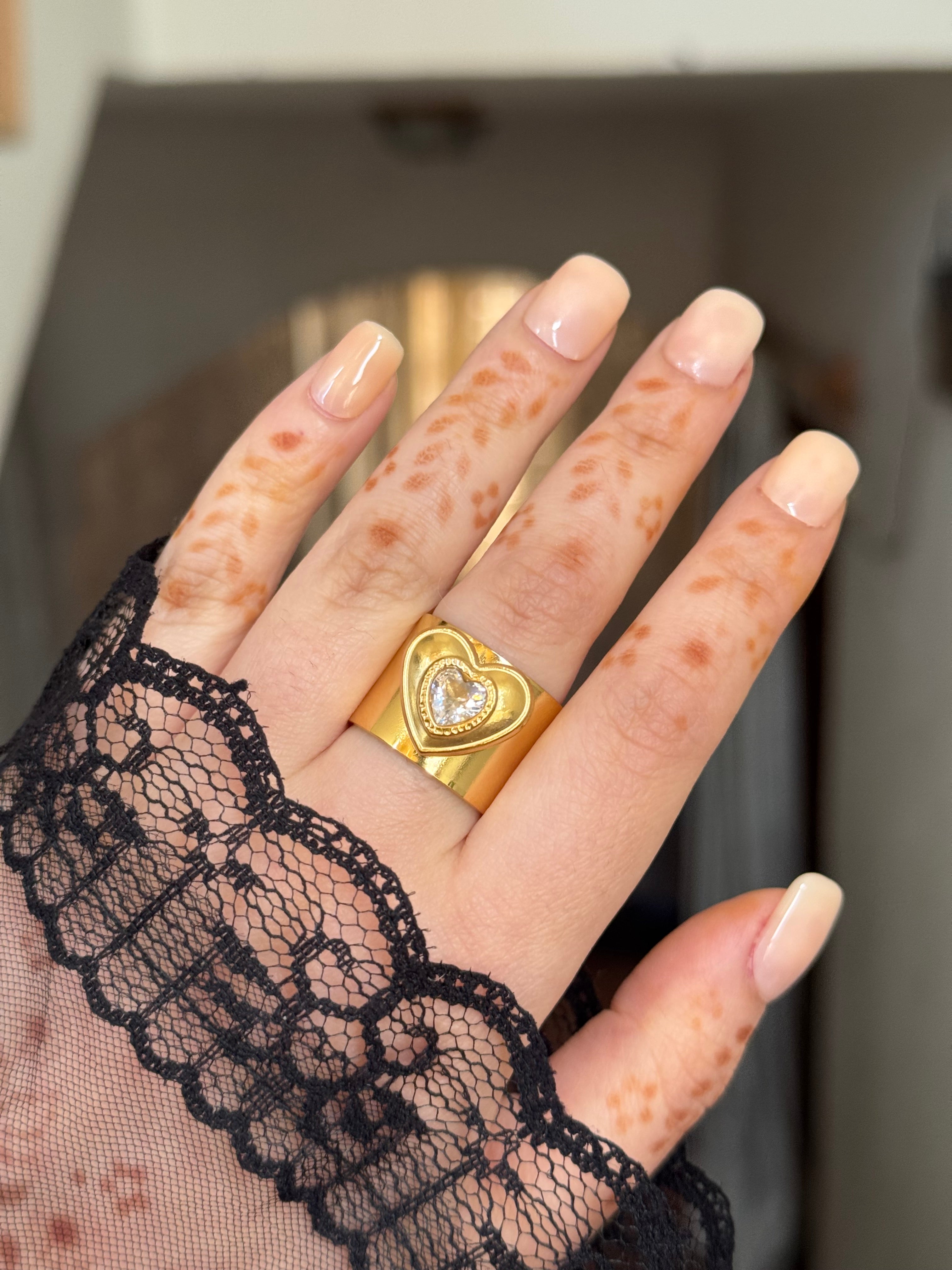 May ring