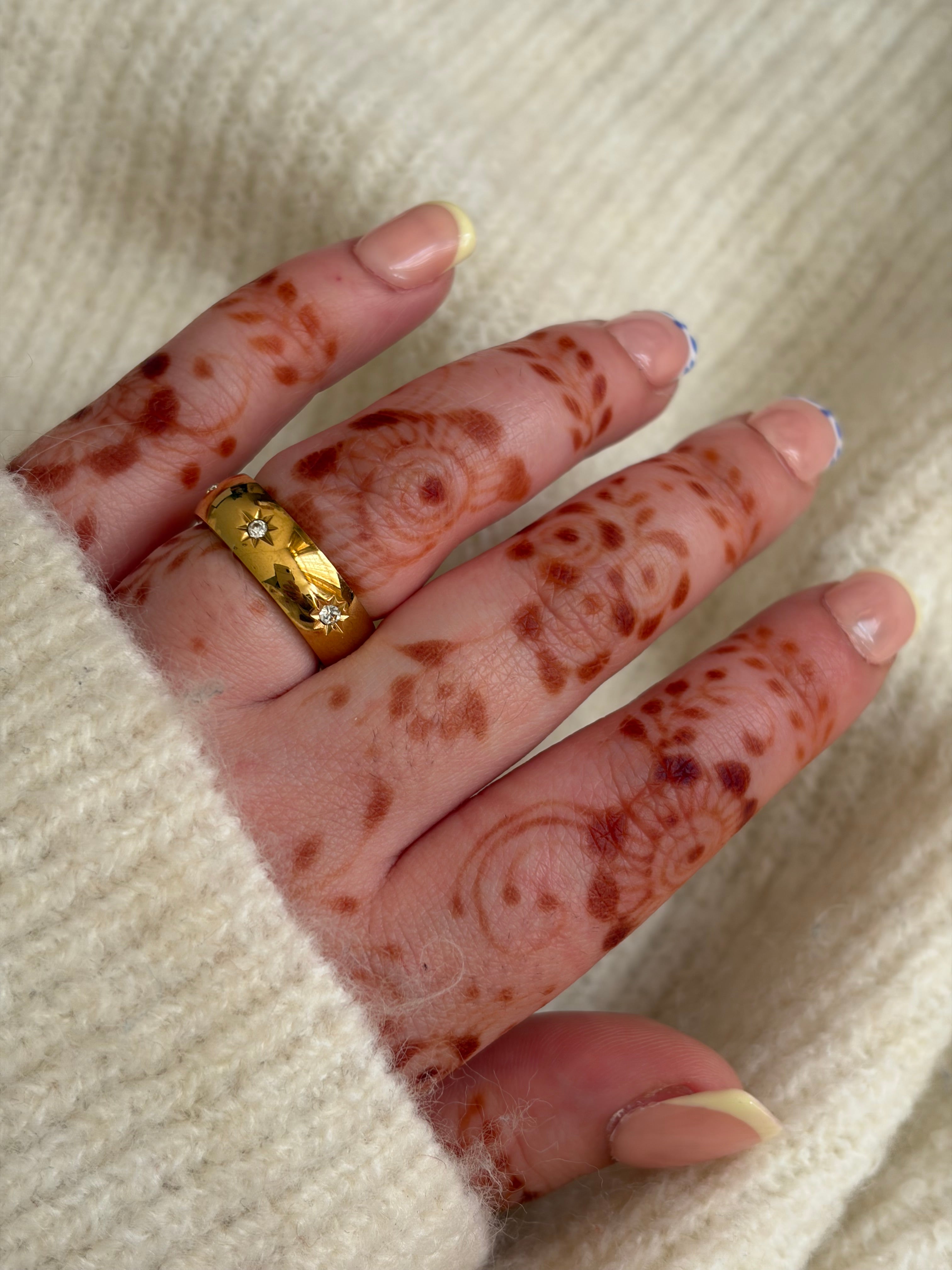 Ibby ring