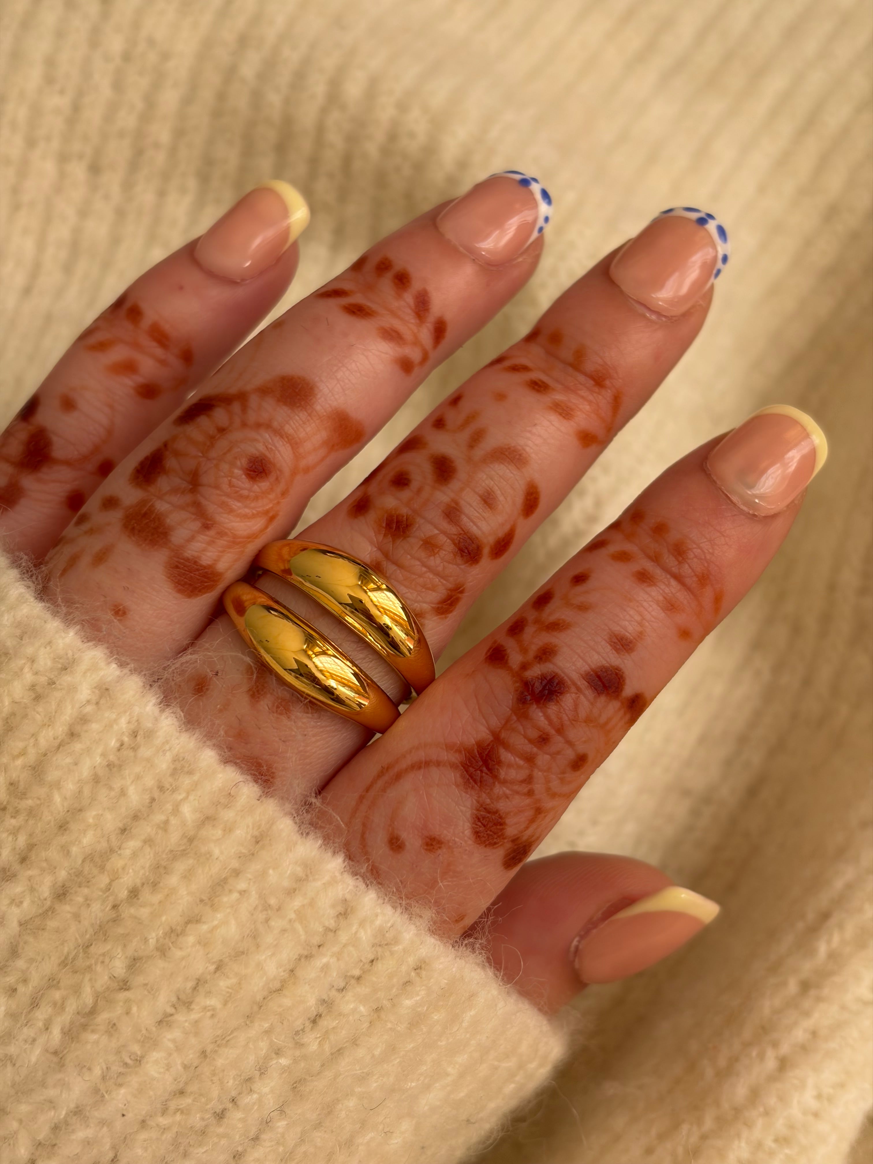 Stellar ring